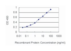 DSC2, Mouse, Clone: 1F2, Abnova 100&mu;g; Unlabeled:Antibodies, Monoclonal