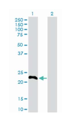 TSC22 domain family, member 3, Rabbit, Purified MaxPab Polyclonal Antibody,