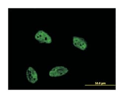 dual specificity phosphatase 4, Mouse, Clone: 1D12, Abnova 100&mu;g; Unlabeled:Antibodies,