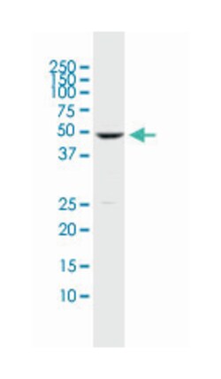 DUSP5 (M04), Mouse anti-Human, Clone: 2F3, Abnova 100&mu;g; Unlabeled:Antibodies,