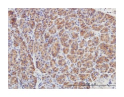 dual specificity phosphatase 6, Mouse, Clone: 3G2, Abnova 100 &mu;g | Buy Online | Abnova | Fisher Scientific