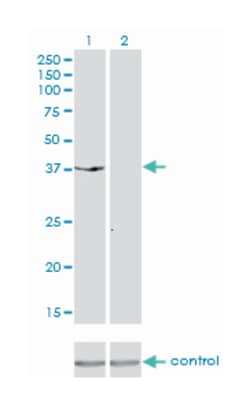 dual specificity phosphatase 6, Mouse, Clone: 3G2, Abnova 100 &mu;g | Buy Online | Abnova | Fisher Scientific