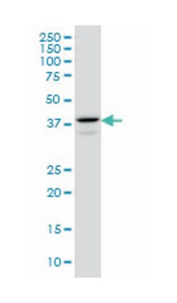 E2F4, Mouse, Clone: 5B7, Abnova 100&mu;g; Unlabeled:Antibodies, Monoclonal