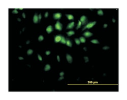 E2F transcription factor 6, Mouse, Clone: 1F7-A9, Abnova 100&mu;g; Unlabeled:Antibodies,
