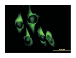 eukaryotic translation elongation factor 1 delta (guanine nucleotide exchange