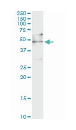 EEF1G, Mouse, Clone: S1, Abnova 100&mu;g; Unlabeled:Antibodies, Monoclonal