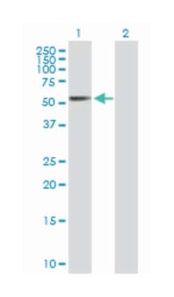 retinoic acid receptor, beta, Mouse, Polyclonal Antibody, Abnova 50 &mu;g | Buy Online | Abnova | Fisher Scientific