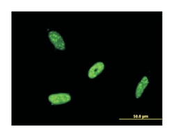 RNA binding motif, single stranded interacting protein 2, Mouse, Clone: 4E2, Abnova™