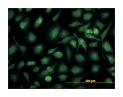 retinaldehyde binding protein 1, Mouse, Clone: 4H5, Abnova 100&mu;g; Unlabeled:Antibodies,