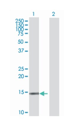 S100 calcium binding protein A7 (B01), Mouse anti-Human, Polyclonal Antibody, Abnova&trade;