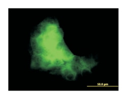 S100 calcium binding protein A7, Mouse, Clone: 1C1, Abnova 100&mu;g; Unlabeled:Antibodies,