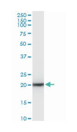 SAT, Mouse, Polyclonal Antibody, Abnova 50&mu;L; Unlabeled:Antibodies,