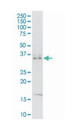 MSX1, Mouse, Clone: 1E2, Abnova&trade;
