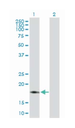 NADH dehydrogenase (ubiquinone) 1 beta subcomplex, 7, 18kDa, Rabbit, Purified