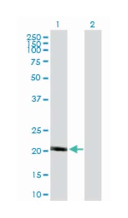 NADH dehydrogenase (ubiquinone) 1 beta subcomplex, 10, 22kDa, Mouse, Purified
