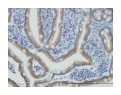 natriuretic peptide receptor B/guanylate cyclase B (atrionatriuretic peptide receptor B), Mouse, Clone: 1E4, Abnova™