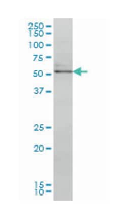 NR4A2, Mouse, Clone: 2G5, Abnova 100 &mu;g | Buy Online | Abnova Corporation | Fisher Scientific