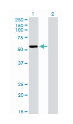 purinergic receptor P2X, ligand-gated ion channel, 5, Rabbit, Purified