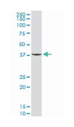 protein phosphatase 1, regulatory (inhibitor) subunit 3C (D01P), Rabbit