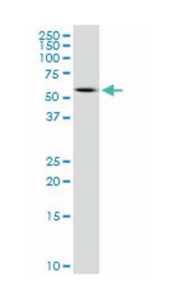 PRPH, Mouse, Clone: 3B3, Abnova 100&mu;g; Unlabeled:Antibodies, Monoclonal