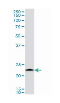 proteasome (prosome, macropain) subunit, beta type, 6, Mouse, Clone: S51,