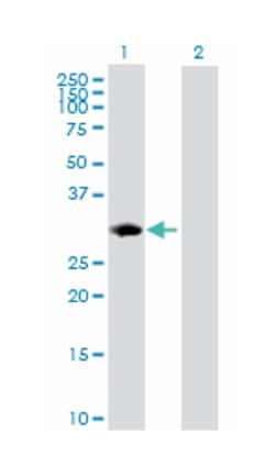 proteasome (prosome, macropain) subunit, beta type, 8 (large multifunctional