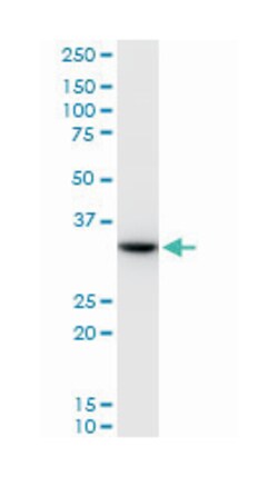 sex hormone-binding globulin, Mouse, Polyclonal Antibody, Abnova 50&mu;L;