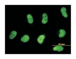 SWI/SNF related, matrix associated, actin dependent regulator of chromatin,