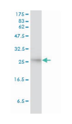 anti-SMN2, Clone: 2B11-2A9, Abnova 100 &mu;g | Buy Online | Abnova Corporation | Fisher Scientific