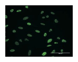 anti-SMN2, Clone: 2B11-2A9, Abnova 100 &mu;g | Buy Online | Abnova Corporation | Fisher Scientific