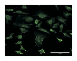 SNCB, Mouse, Clone: 3G6, Abnova 100 &mu;g | Buy Online | Abnova Corporation | Fisher Scientific