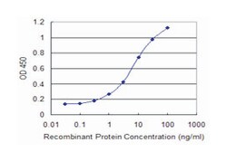 small nuclear RNA activating complex, polypeptide 4, 190kDa, Mouse, Clone: 1D1, Abnova 100 &mu;g | Buy Online | Abnova Corporation | Fisher Scientific