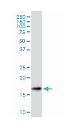 SNCG, Mouse, Clone: 2C3, Abnova 200&mu;L; Unlabeled:Antibodies, Monoclonal