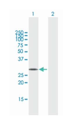 syntrophin, beta 2 (dystrophin-associated protein A1, 59kDa, basic component