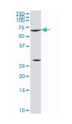serum response factor (c-fos serum response element-binding transcription