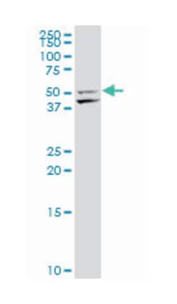 transcription factor CP2, Mouse, Polyclonal Antibody, Abnova 50&mu;L; Unlabeled:Antibodies,