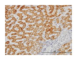 ubiquitin-conjugating enzyme E2G 2 (UBC7 homolog, yeast), Mouse, Clone: