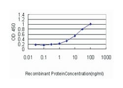visinin-like 1, Mouse, Clone: 2F1-E3, Abnova 100 &mu;g | Buy Online | Abnova Corporation | Fisher Scientific