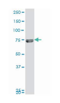 zinc finger protein 14, Mouse, Polyclonal Antibody, Abnova 50&mu;L; Unlabeled:Antibodies,