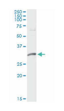dynein, axonemal, light intermediate chain 1, Mouse, Clone: 2H3, Abnova