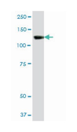 SWI/SNF related, matrix associated, actin dependent regulator of chromatin, subfamily a, member 5 (B01), Mouse anti-Human, Polyclonal Antibody, Abnova&trade;