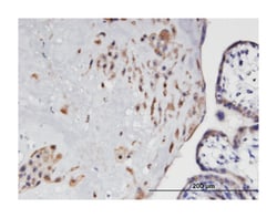 EDG3, Mouse, Clone: 2G11, Abnova 100&mu;g; Unlabeled:Antibodies, Monoclonal
