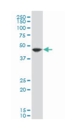 eukaryotic translation elongation factor 1 alpha 2, Mouse, Polyclonal Antibody,