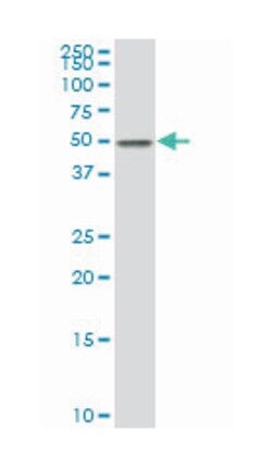 eukaryotic translation elongation factor 1 alpha 2, Mouse, Polyclonal Antibody,