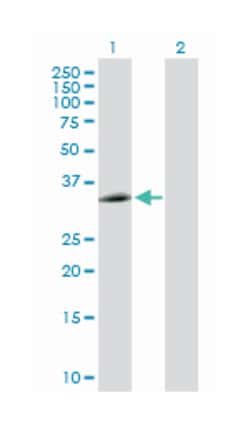 eukaryotic translation elongation factor 1 delta (guanine nucleotide exchange
