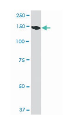 epidermal growth factor receptor (erythroblastic leukemia viral (v-erb-b)