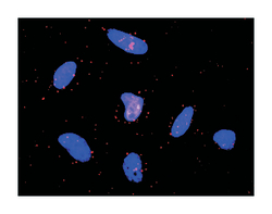 epidermal growth factor receptor (erythroblastic leukemia viral (v-erb-b)