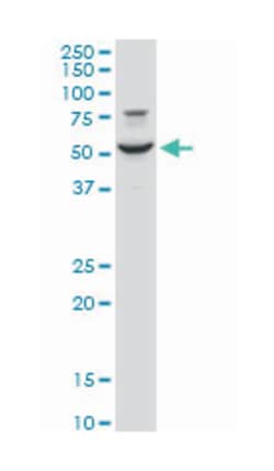 early growth response 1, Mouse, Polyclonal Antibody, Abnova 50&mu;L; Unlabeled:Antibodies,