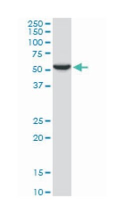 early growth response 1, Mouse, Polyclonal Antibody, Abnova 50&mu;L; Unlabeled:Antibodies,