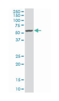 early growth response 1, Mouse, Polyclonal Antibody, Abnova 50&mu;L; Unlabeled:Antibodies,